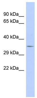 WB Suggested Anti-TRIM34 Antibody Titration: 0.2-1 ug/ml; ELISA Titer: 1: 12500; Positive Control: Human Thymus