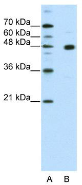 WB Suggested Anti-PRDM12 Antibody Titration: 2.5 ug/ml; ELISA Titer: 1: 62500; Positive Control: HepG2 cell lysate