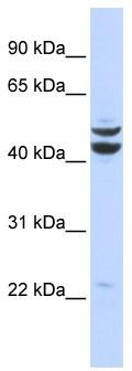 WB Suggested Anti-PKNOX2 Antibody Titration: 0.2-1 ug/ml; ELISA Titer: 1: 62500; Positive Control: 293T cell lysate