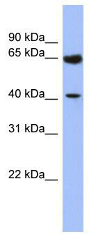WB Suggested Anti-LASS2 Antibody Titration: 0.2-1 ug/ml; ELISA Titer: 1: 1562500; Positive Control: Human kidney