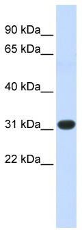 WB Suggested Anti-HOXC8 Antibody Titration: 1 ug/ml; Positive Control: Fetal Muscle cell lysate