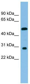 WB Suggested Anti-HOXC8 Antibody Titration: 0.2-1 ug/ml; ELISA Titer: 1: 12500; Positive Control: COLO205 cell lysate