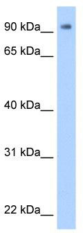WB Suggested Anti-ZNF408 Antibody Titration: 0.2-1 ug/ml; Positive Control: Transfected 293T