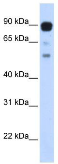 WB Suggested Anti-ZNF408 Antibody Titration: 0.2-1 ug/ml; ELISA Titer: 1: 12500; Positive Control: Transfected 293T