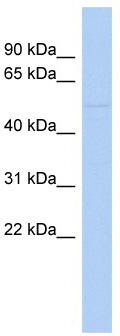 WB Suggested Anti-ZNF669 Antibody Titration: 0.2-1 ug/ml; ELISA Titer: 1: 1562500; Positive Control: COLO205 cell lysate
