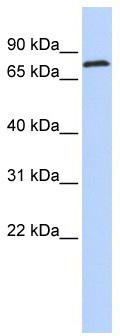 WB Suggested Anti-ZNF613 Antibody Titration: 0.2-1 ug/ml; ELISA Titer: 1: 12500; Positive Control: Hela cell lysate