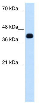 WB Suggested Anti-ZSCAN16 Antibody Titration: 0.625 ug/ml; ELISA Titer: 1: 62500; Positive Control: Transfected 293T