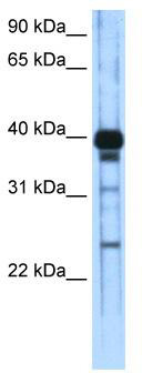 WB Suggested Anti-ZSCAN16 Antibody Titration: 0.2-1 ug/ml; ELISA Titer: 1: 62500; Positive Control: Transfected 293T