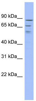 WB Suggested Anti-C1orf25 Antibody Titration: 0.2-1 ug/ml; ELISA Titer: 1: 62500; Positive Control: ACHN cell lysate; TRMT1L is supported by BioGPS gene expression data to be expressed in ACHN