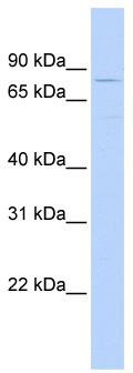 WB Suggested Anti-TRIM56 Antibody Titration: 0.2-1 ug/ml; ELISA Titer: 1: 312500; Positive Control: MCF7 cell lysate