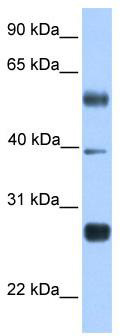 WB Suggested Anti-MXD3 Antibody Titration: 0.2-1 ug/ml; ELISA Titer: 1: 62500; Positive Control: Transfected 293T