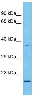 Host: Rabbit; Target Name: MXD3; Sample Tissue: Esophagus Tumor lysates; Antibody Dilution: 1.0 ug/ml