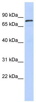 WB Suggested Anti-ZNF333 Antibody Titration: 0.2-1 ug/ml; ELISA Titer: 1: 12500; Positive Control: Human Muscle