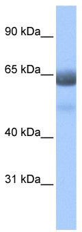 WB Suggested Anti-RFX4 Antibody Titration: 0.2-1 ug/ml; ELISA Titer: 1: 312500; Positive Control: Human Lung