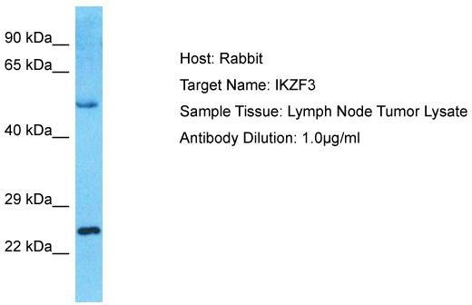 Host: Rabbit; Target Name: IKZF3; Sample Tissue: Lymph Node Tumor lysates; Antibody Dilution: 1.0 ug/ml