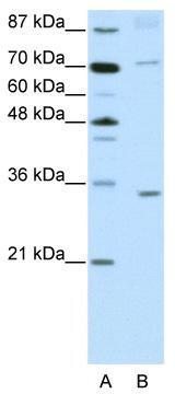 WB Suggested Anti-ATOH8 Antibody Titration: 2.5 ug/ml; ELISA Titer: 1: 12500; Positive Control: Jurkat cell lysate