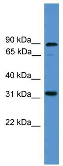 WB Suggested Anti-ATOH8 Antibody Titration: 0.2-1 ug/ml; ELISA Titer: 1: 12500; Positive Control: COLO205 cell lysate