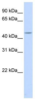 WB Suggested Anti-HSFY1 Antibody Titration: 0.2-1 ug/ml; ELISA Titer: 1: 1562500; Positive Control: Human Lung