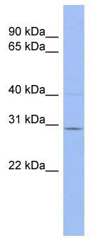 WB Suggested Anti-TRIM14 Antibody Titration: 0.2-1 ug/ml; ELISA Titer: 1: 1562500; Positive Control: THP-1 cell lysate