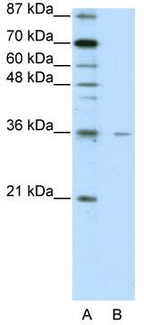 WB Suggested Anti-FOXQ1 Antibody Titration: 2.5 ug/ml; ELISA Titer: 1: 12500; Positive Control: HepG2 cell lysate