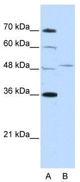 WB Suggested Anti-FOXQ1 Antibody Titration: 2.5 ug/ml; Positive Control: Jurkat cell lysate