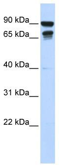 WB Suggested Anti-MSL3L1 Antibody Titration: 0.2-1 ug/ml; ELISA Titer: 1: 62500; Positive Control: 293T cell lysate; MSL3 is supported by BioGPS gene expression data to be expressed in HEK293T
