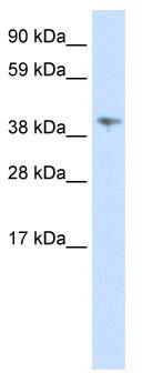 WB Suggested Anti-MSL3L1 Antibody Titration: 0.625 ug/ml; ELISA Titer: 1: 62500; Positive Control: Human Spleen