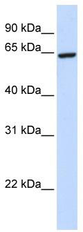 WB Suggested Anti-ZNF280B Antibody Titration: 0.2-1 ug/ml; ELISA Titer: 1: 12500; Positive Control: 293T cell lysate