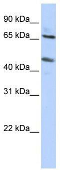 WB Suggested Anti-SLC26A10 Antibody Titration: 0.2-1 ug/ml; ELISA Titer: 1: 62500; Positive Control: HepG2 cell lysate