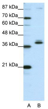 WB Suggested Anti-ZNF25 Antibody Titration: 1.25 ug/ml; ELISA Titer: 1: 62500; Positive Control: HepG2 cell lysate
