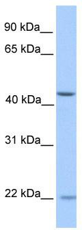 WB Suggested Anti-ZNF485 Antibody Titration: 0.2-1 ug/ml; Positive Control: Human Liver