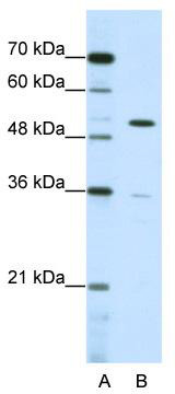 WB Suggested Anti-ZNF485 Antibody Titration: 0.2-1 ug/ml; ELISA Titer: 1: 62500; Positive Control: HepG2 cell lysate