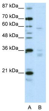 WB Suggested Anti-ZNF440 Antibody Titration: 2.5 ug/ml; ELISA Titer: 1: 312500; Positive Control: HepG2 cell lysate