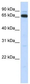 WB Suggested Anti-KBTBD5 Antibody Titration: 0.2-1 ug/ml; ELISA Titer: 1: 312500; Positive Control: Human Muscle