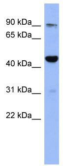WB Suggested Anti-ZNF569 Antibody Titration: 0.2-1 ug/ml; ELISA Titer: 1: 62500; Positive Control: Human Thymus