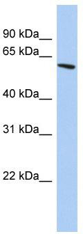 WB Suggested Anti-ZNF567 Antibody Titration: 0.2-1 ug/ml; ELISA Titer: 1: 1562500; Positive Control: PANC1 cell lysate
