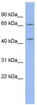 WB Suggested Anti-MIER3 Antibody Titration: 0.2-1 ug/ml; ELISA Titer: 1: 62500; Positive Control: COLO205 cell lysate