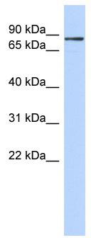WB Suggested Anti-ZNF366 Antibody Titration: 0.2-1 ug/ml; ELISA Titer: 1: 62500; Positive Control: 721_B cell lysate