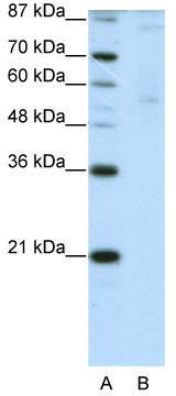 WB Suggested Anti-ZNF92 Antibody Titration: 2.5 ug/ml; ELISA Titer: 1: 12500; Positive Control: HepG2 cell lysate