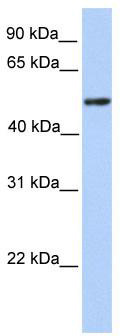 WB Suggested Anti-ZBTB9 Antibody Titration: 0.2-1 ug/ml; Positive Control: Transfected 293T