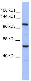 WB Suggested Anti-ZFPM1 Antibody Titration: 0.2-1 ug/ml; ELISA Titer: 1: 62500; Positive Control: THP-1 cell lysate