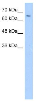 WB Suggested Anti-ZNF57 Antibody Titration: 5.0 ug/ml; Positive Control: Jurkat cell lysate