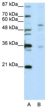WB Suggested Anti-ZNF57 Antibody Titration: 5.0 ug/ml; ELISA Titer: 1: 62500; Positive Control: Jurkat cell lysate