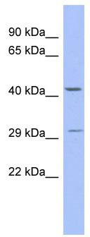 WB Suggested Anti-ZNF575 Antibody Titration: 0.2-1 ug/ml; ELISA Titer: 1: 1562500; Positive Control: Human Stomach