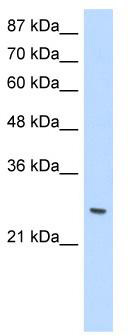 WB Suggested Anti-ZNF575 Antibody Titration: 1.25 ug/ml; Positive Control: Jurkat cell lysate