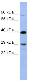 WB Suggested Anti-OLIG3 Antibody Titration: 0.2-1 ug/ml; ELISA Titer: 1: 312500; Positive Control: COLO205 cell lysate