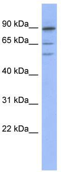 WB Suggested Anti-TRIM50 Antibody Titration: 0.2-1 ug/ml; ELISA Titer: 1: 1562500; Positive Control: COLO205 cell lysate