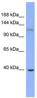 WB Suggested Anti-ZNF827 Antibody Titration: 0.2-1 ug/ml; ELISA Titer: 1: 1562500; Positive Control: HepG2 cell lysate
