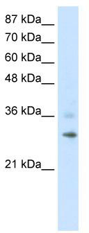 WB Suggested Anti-RNF113B Antibody Titration: 1.25 ug/ml; ELISA Titer: 1: 312500; Positive Control: HepG2 cell lysate
