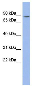 WB Suggested Anti-ZNF568 Antibody Titration: 0.2-1 ug/ml; ELISA Titer: 1: 62500; Positive Control: OVCAR-3 cell lysate